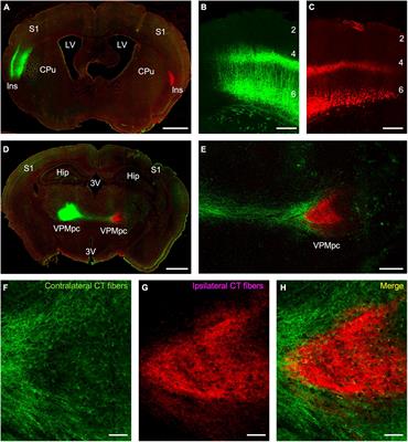 Crossed Connections From Insular Cortex to the Contralateral Thalamus